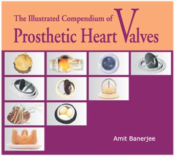The Illustrated Compendium of Prosthetic Heart Valves