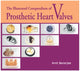 The Illustrated Compendium of Prosthetic Heart Valves